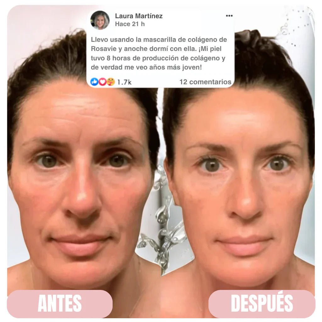 GLASS - MASCARILLA DE COLÁGENO